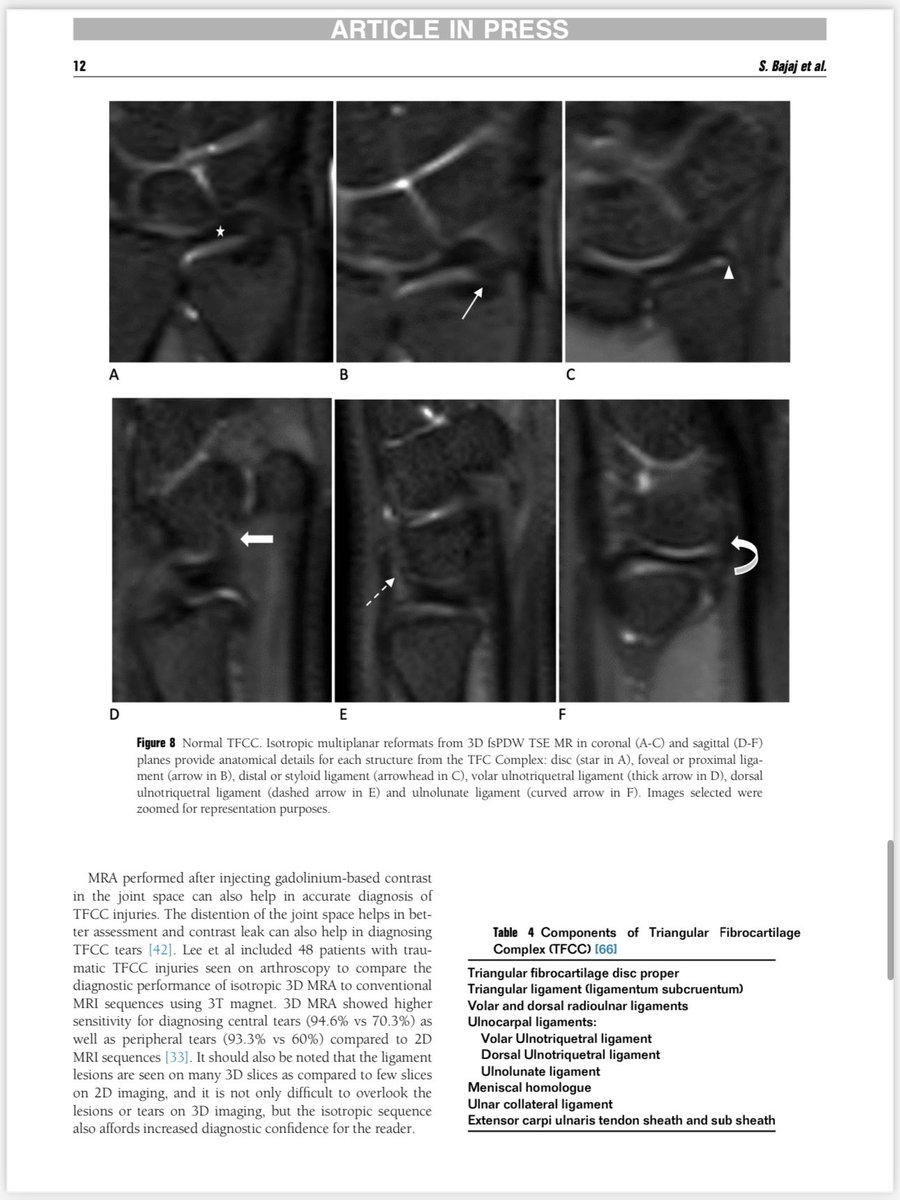 Our paper on “3D MRI of Wrist” is available now in Seminars in Roentgenology. Enjoy a review on anatomy and clinical applications of this technique! 🔗 shorturl.at/msBIO @UTSW_RadRes @UTSW_Radiology @AChhabraMD @bajaj_MD #radiology #orthopedics #mri #handsurgery #radres