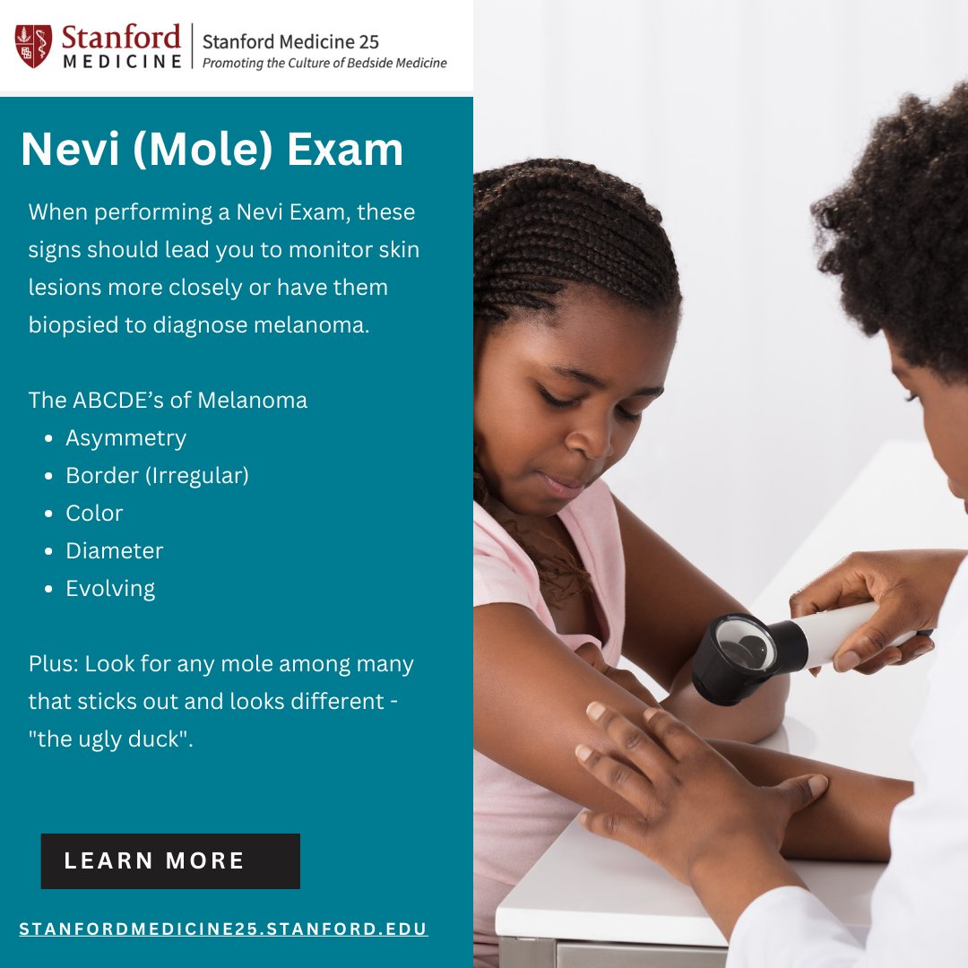 All #nevi should be taken seriously as they may indicate cancer. Before making a diagnosis of any skin lesion, it's important to be able to accurately describe the skin lesion. Review the characteristics of moles that should increase suspicion of cancer: stanford.io/3xaQuPg