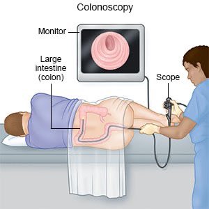 Did 'old man' medical procedures today @AtlanticHealth

The parallelism of procedures reminded me of a cyber security assessment. A blog post and slide presentation forthcoming