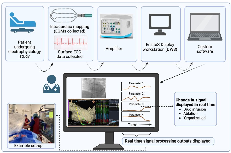 Live signal processing in the EP Lab is hard... We've made a plug-in #WaveWatch5000 so any #EnsiteX lab can do this quickly and easily! DM to try! @KathrynTiver @ephemble @DariusChapman @DDharmaprani #EPeeps 👇 doi.org/10.1111/jce.16… 👊 github.com/anand9176/Wave…