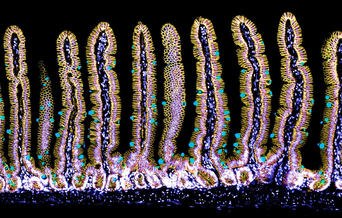 Can you ever have too many villi pictures 🤷‍♀️, I just love them. #FluorescenceFriday #FluorescentFriday #bioart #sciart #pathart #histoart #intestine #microscopy #immunostaining