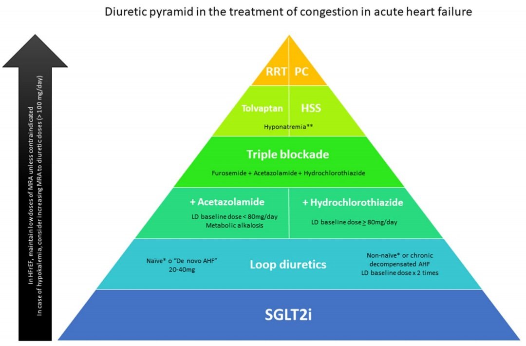 javier20ch's tweet photo. Combinación de diuréticos en la insuficiencia cardíaca. 💊💊🫀💥
♦️En las primeras etapas de la ICA, los 👥️ suelen responder bien a la monoterapia con diurético de asa. A medida que la enfermedad avanza, las comorbilidades (ERC) y el uso crónico de diuréticos de asa provocan que la eficacia diurética disminuya.
♦️Hasta un 20-30% de los 👥️ ingresados por ICA, requerirán una combinación de diuréticos para mejorar la respuesta diurética y lograr la descongestión. 
♦️Mecanismos: absorción alterada, disminución del flujo sanguíneo renal, azotemia, hipoalbuminemia, proteinuria.
♦️"Fenómeno de frenado" ➡️ aumento secundario en la absorción de NaCl por remodelado de la nefrona, hipertrofia del túbulo contorneado distal, túbulo conector y el conducto colector.
✅️Algoritmo piramidal propuesto para combinaciones de diuréticos:⤵️

📚⚡️⤵️:
https://t.co/Zo4YsmJRc5
https://t.co/dD2Xf2Qcfa