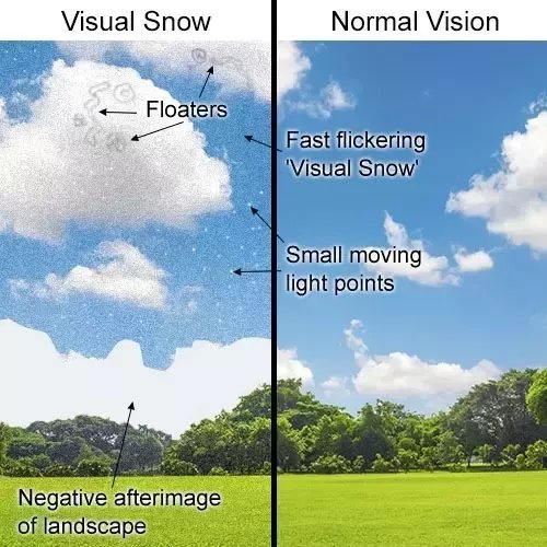JasGetsCrazy's tweet image. Do you have normal vision or experience #visualsnow?

#AskTwitter