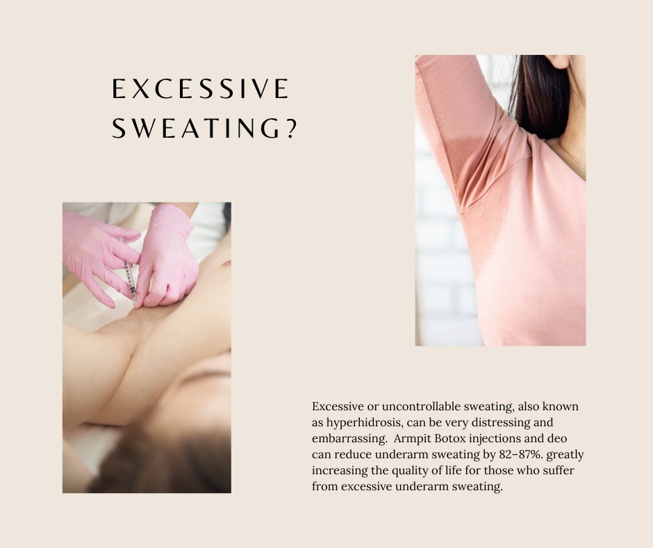 ByEpf's tweet photo. We’re all feeling the heat this summer. Still, if you’re sweating profusely on dates, at the office, or at home year-round, we can help! Sweating that much without strenuous exercise is called hyperhidrosis.

https://t.co/LExlTrpqQX https://t.co/azYpl6boA2