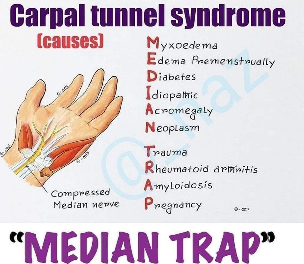 Causes of carpal tunnel syndrome Subscribe 👇 youtube.com/@pgmedicine2023