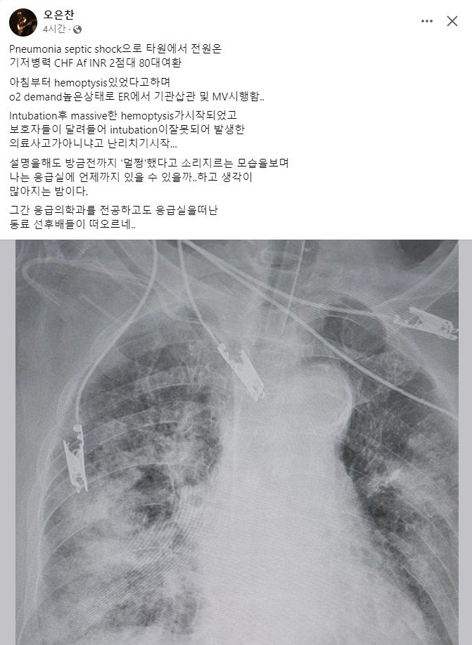 당연히 자연발생할 수 밖에 없는 의료행위에도 불구한 나쁜 결과나 자연적으로 나빠질 것이 예상되는 질병에 대해서 의사들에게 형사적으로나 민사적으로나 뜯어낼 게 있다는 식으로 정부나 이해당사자들인 법조인들이 조장해왔다. 그래서 점점 바이탈과 의사들은 사라진다.