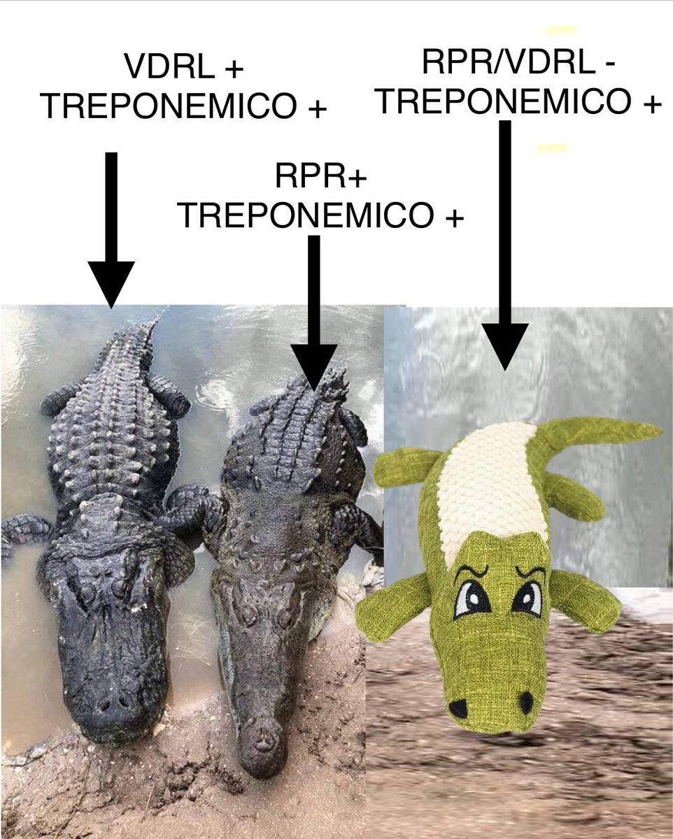 infeccHRUmalaga's tweet photo. La #sifilis va en aumento 📈pero sabes interpretar la serologia?
No TODOS los POSITIVOS son peligrosos!📸👇🏻
🔸Test treponemicos:
FTA, TPHA y ELISA 
🔸Test NO treponemicos:
RPR, VDRL
📚🤓Revisión con interpretación serologia en #EnfInfeccMicrobiolClin 🔗👉🏻🆓https://t.co/YKNyaBIVfK https://t.co/7WLkSSZf5e
