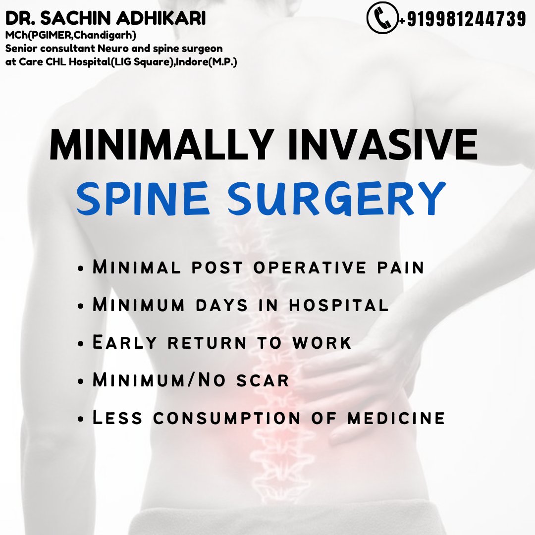 Back pain got you down? Ouch! Check what Minimally invasive spine surgery offers

Consult with me at Care CHL Hospital, Indore Dr. Sachin Adhikari Schedule an Appointment by calling +91-9981244739

#DrSachinAdhikari  #minimal #Consult #carechlhospital #carechlhospitalindore