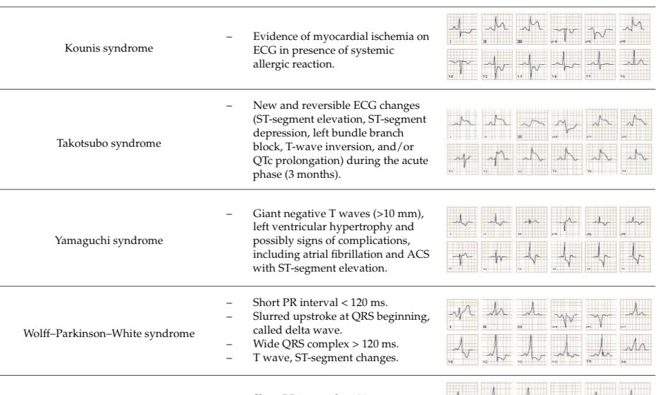 ▶️ 心電図の「〜症候群」のまとめ（元文献は次スレ） ほんと，いろんな名前があるんですね🤔 後でじっくり読んでみます _φ(･_･