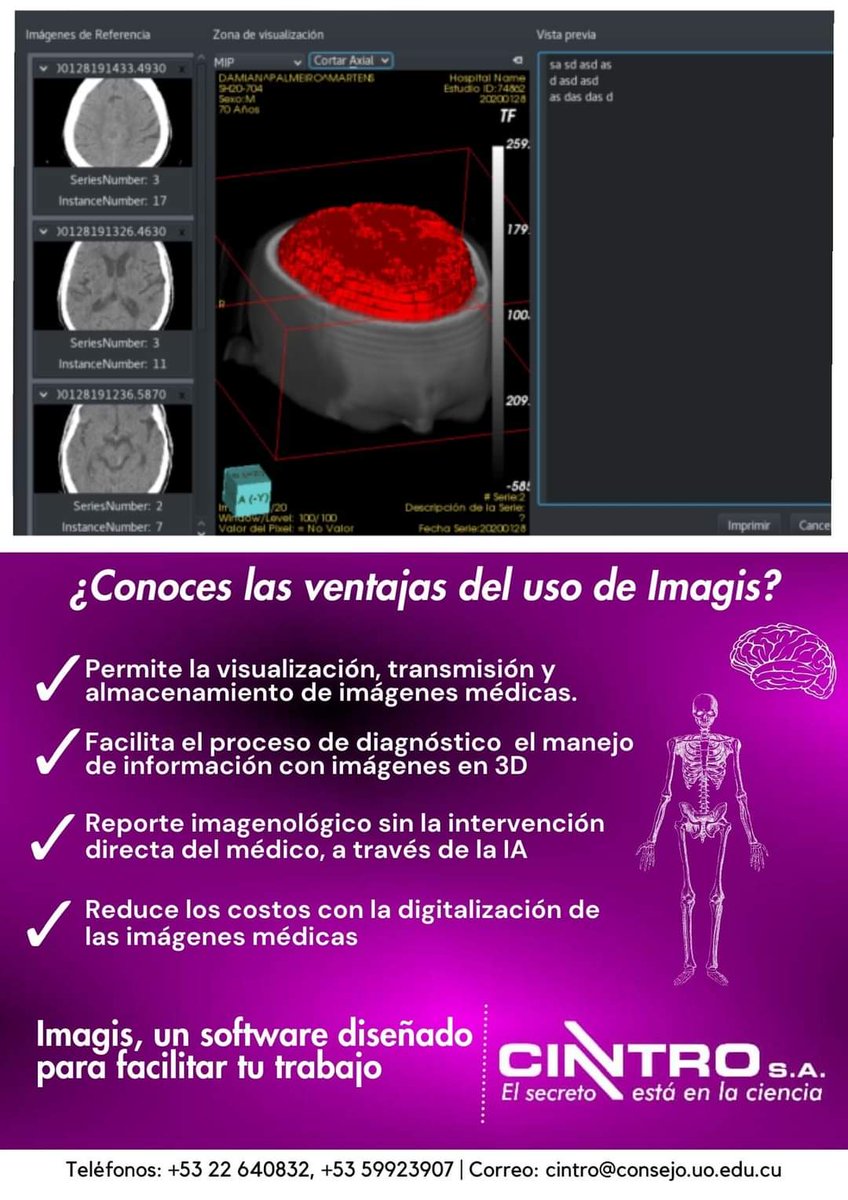 miriammmc's tweet photo. Resultado de la ciencia universitaria. Usada con éxito en hospitales del país. #ElSecretoEstáEnLaCiencia. Cuando más lo necesites, podemos ayudarte! #CINTRO #CBM @UOCuba @DianaSedalYanes https://t.co/jzt7GxOR8G