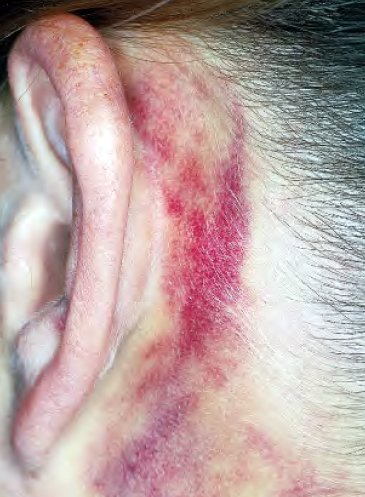 Dr Momin khan tweet media