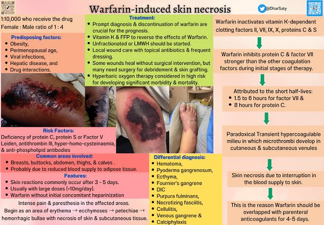 @modernHealthMe Warfarin-induced skin necrosis is a condition in which skin and subcutaneous tissue necrosis (tissue death) occurs due to acquired protein C deficiency following treatment with anti-vitamin K anticoagulants (4-hydroxycoumarins, such as warfarin). Obesity, perimenopausal age,…