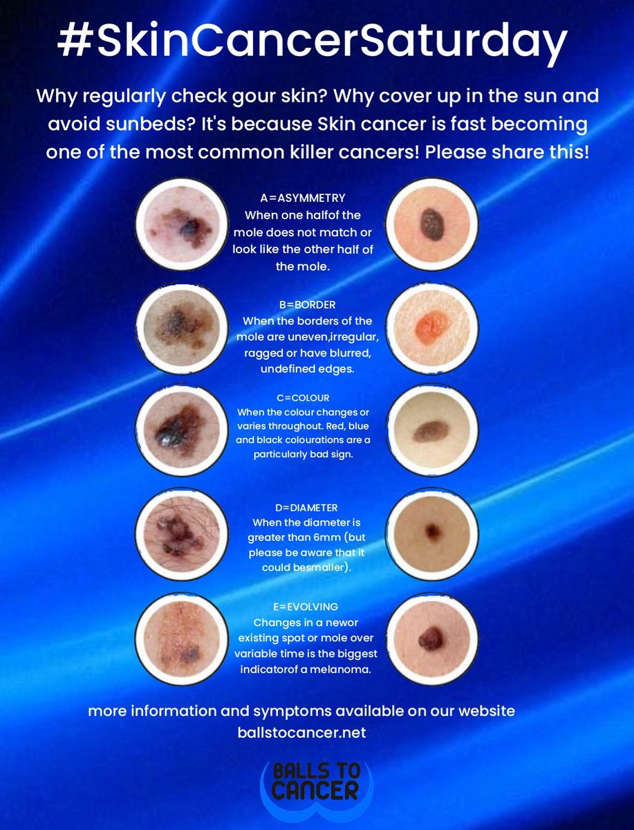 It's a #SkinCancer Saturday. Some don't understand why we ask you to check your skin, use sun block & avoid sunbeds. We do it because skin cancer is rising up that list of cancers as most common killers ballstocancer.net/skin-cancer please share #ballstocancer #CancerSupportCharity