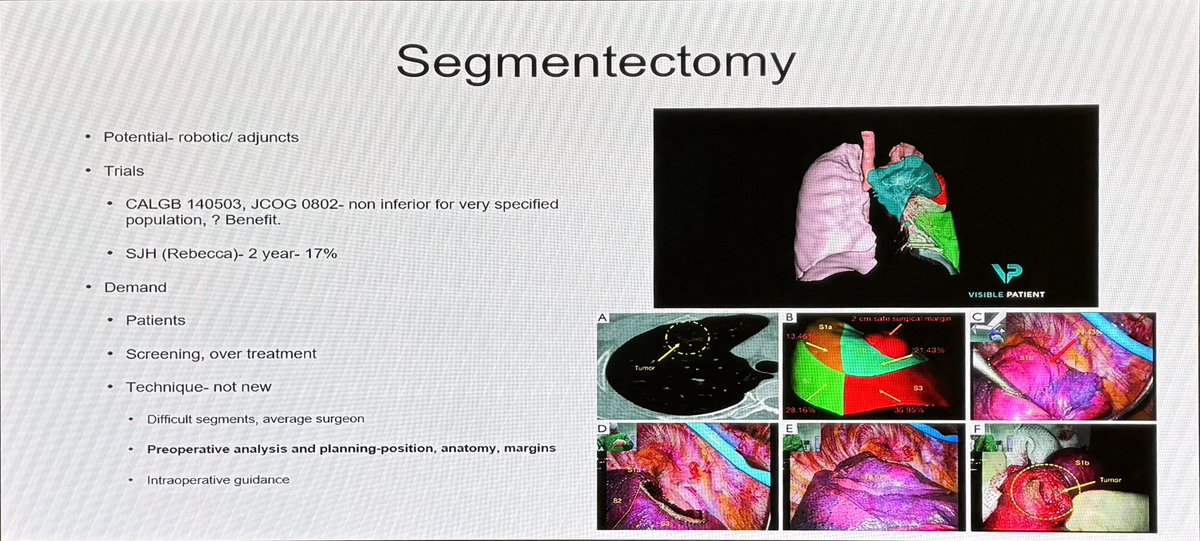 Mr Ronan Ryan from @stjamesdublin gives a though provoking and excellent overview of surgery in #NSCLC Minimally invasive surgery and RATS now established as SOC 📢 national imperative for centralisation @IASLC #AILCC24