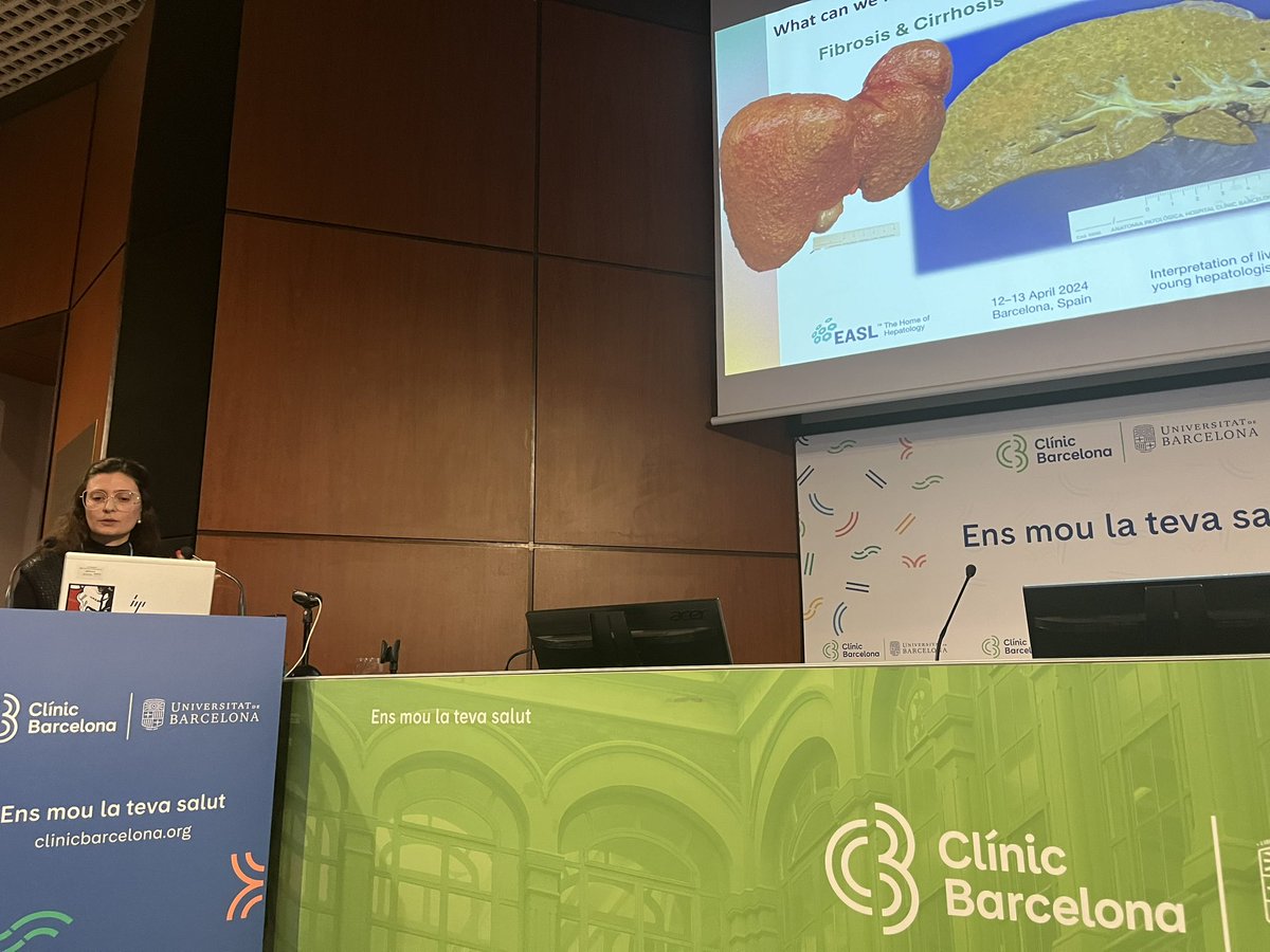 DinaTiniakos's tweet photo. New generation of liver pathologists @hospitalclinic are excellent! Carla Montironi discusses metabolic liver disease @EASLnews #EaslSchool @ESP_Pathology @LiverPath_HPHS @UKLiverPath https://t.co/AEes5LOaKM