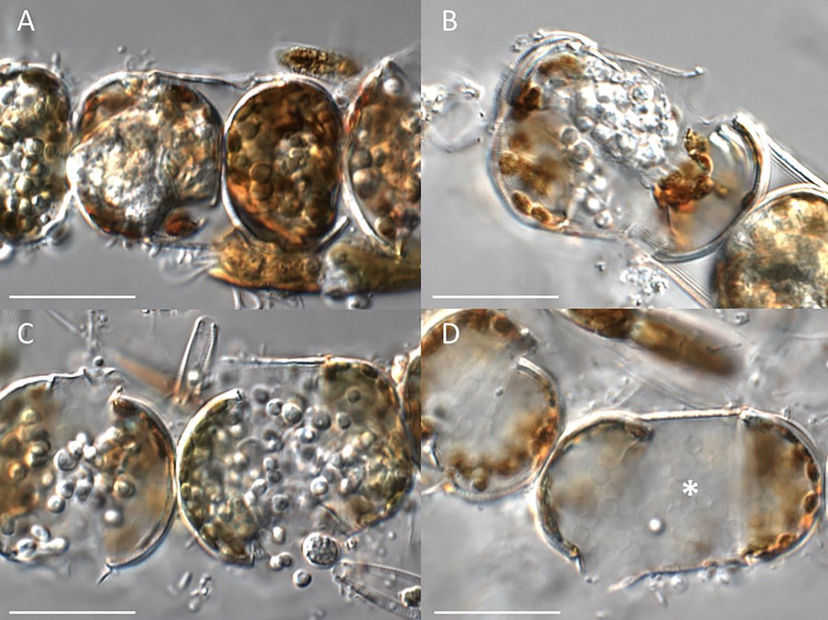 marco_thines's tweet photo. Introducing ✨ Miracula polaris ✨ - a beautiful new oomycete species infecting cold-loving species of Melosira - of which some form dense mats under sea ice. Found in a rock pool at our research station Blávík in East Iceland 🇮🇸.
https://t.co/xLnvnhVST4 https://t.co/rp8H2PLeFA