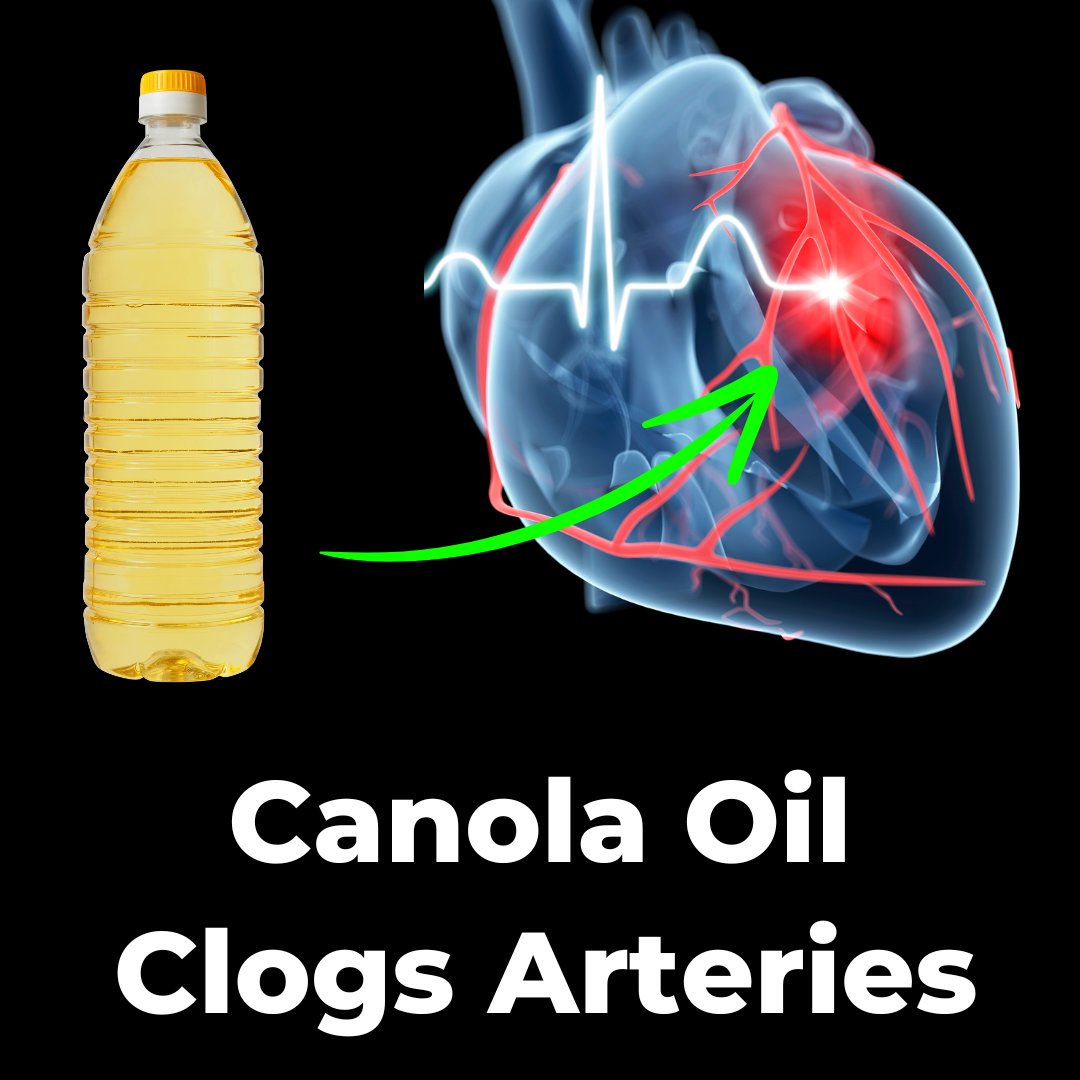 Canola oil is one of the most consumed oils in America & around the world.

It is claimed to be healthy and good for your heart.

But it creates more health issues than you probably realize.

I know, it’s a bold claim.

But I can back it up.

THREAD