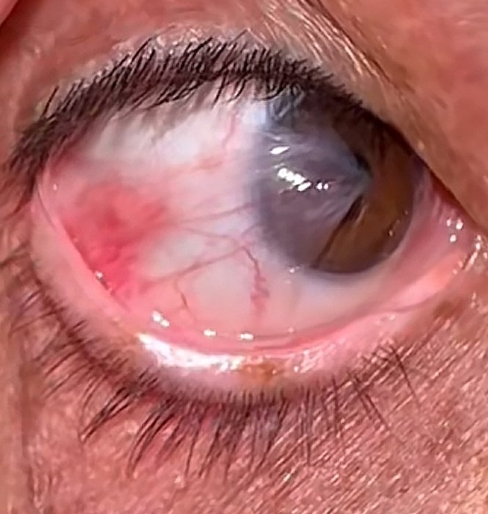 What is ocular diagnosis?
What is unique?
#MedTwitter #MedEd #Medicine #opthalmology
