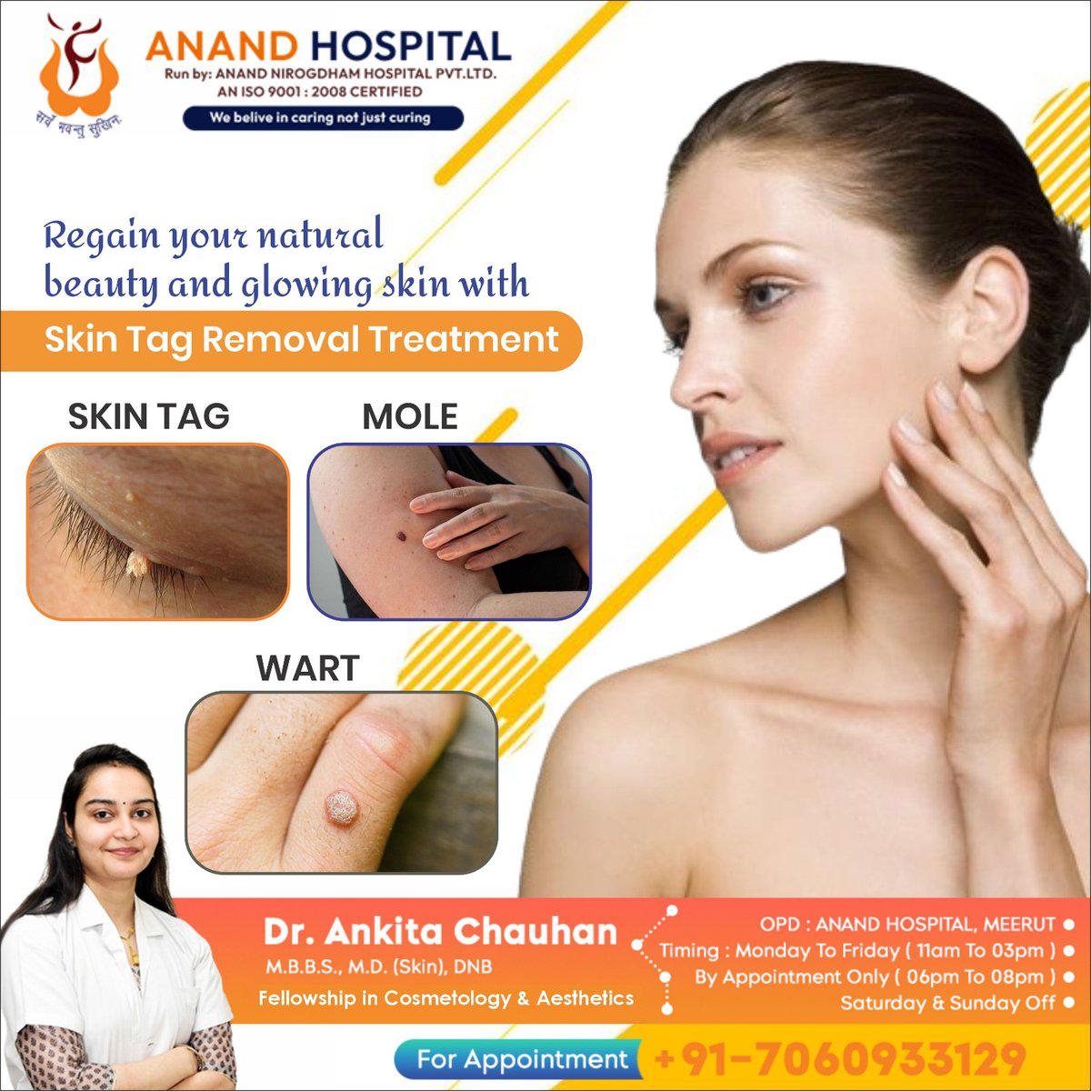 Regain your natural beauty and glowing skin with Skin Tag Removal Treatment
.
linktr.ee/dr_ankitachauh…
.
#drankitachauhan #skinspecialist #cosmetologist #dermatologist #skintagremoval #skincare #moleremoval #wartremoval #microneedling #miliaremoval #anandhospital #meerut