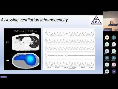 Advanced Monitoring During Mechanical Ventilation. Society Of Mechanical Ventilation Conference 2023. Ehab Daoud youtu.be/NkZMbe1lGQ8