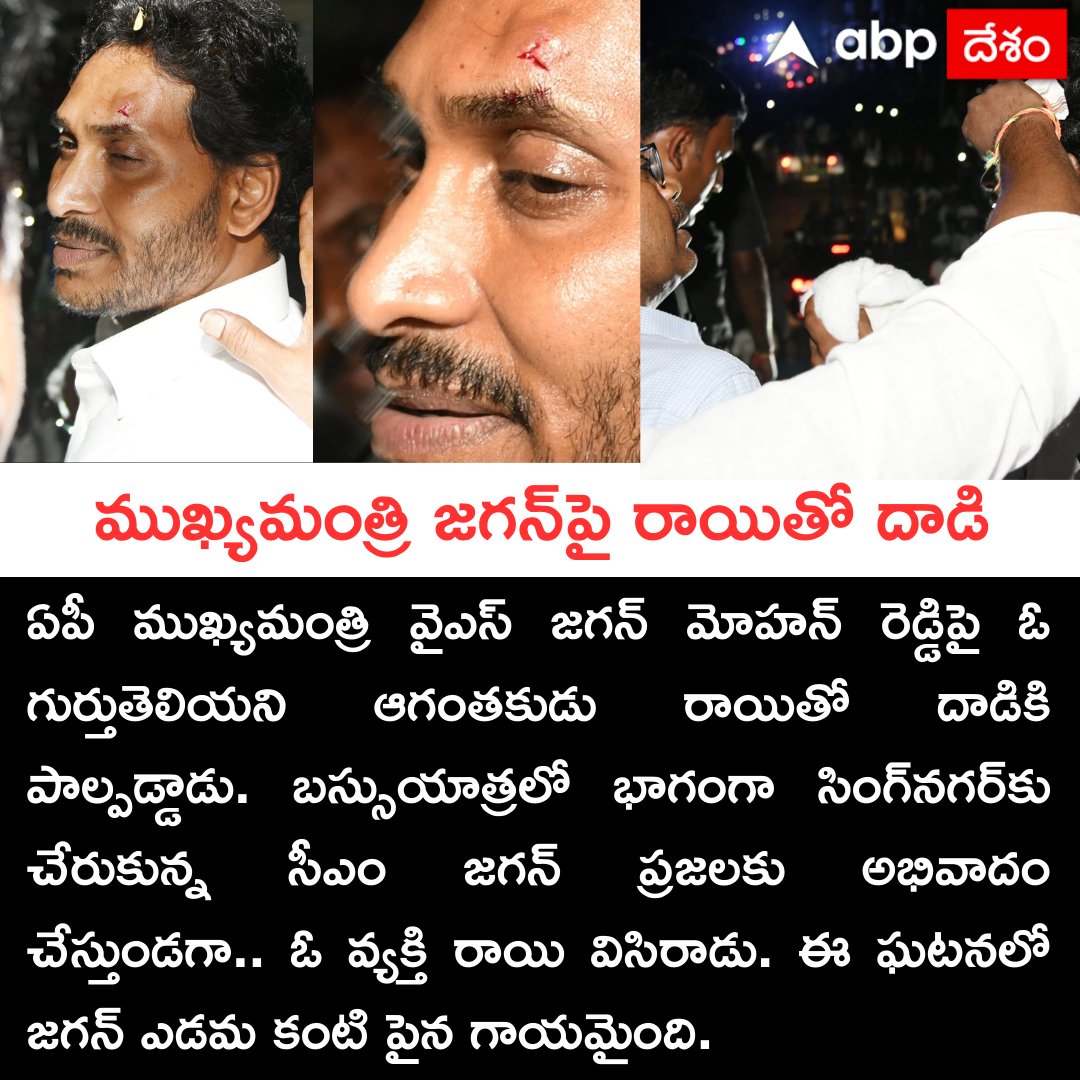 ముఖ్యమంత్రి జగన్‌పై రాయితో దాడి
#CMJagan #Stone #Attack #YSRCP #busyatra #APNews #APPolitics