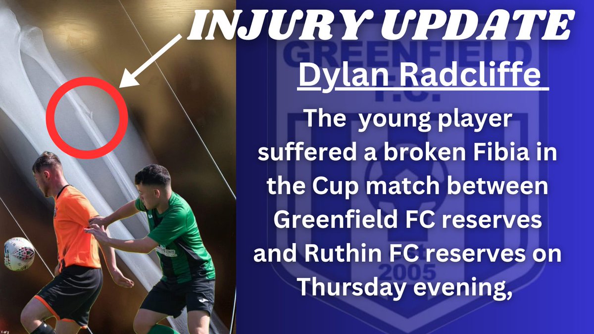 Following his injury on Thursday night Everyone at @Greenfieldfc wishes Dylan Radcliffe a speedy recovery