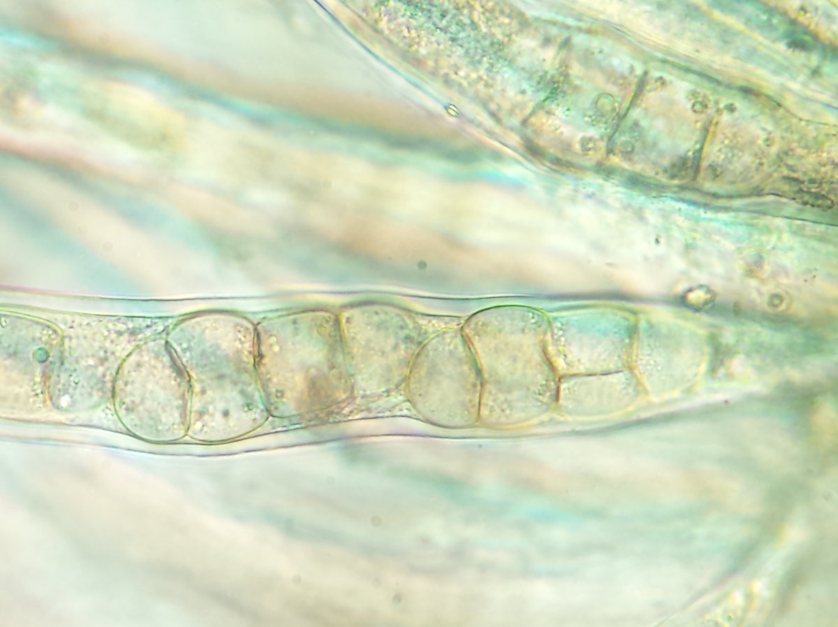 PavelSinkyrik's tweet photo. #Pyrenophora tritici-repentis #DTR is one of the most important #wheat diseases in the Czechia. It is spread from patches by #conidia during the growing season and primary infection is caused by #ascospores from black #pseudoperithecia growing on the residues #plantdisease #fungi https://t.co/yOgsWsTf2j