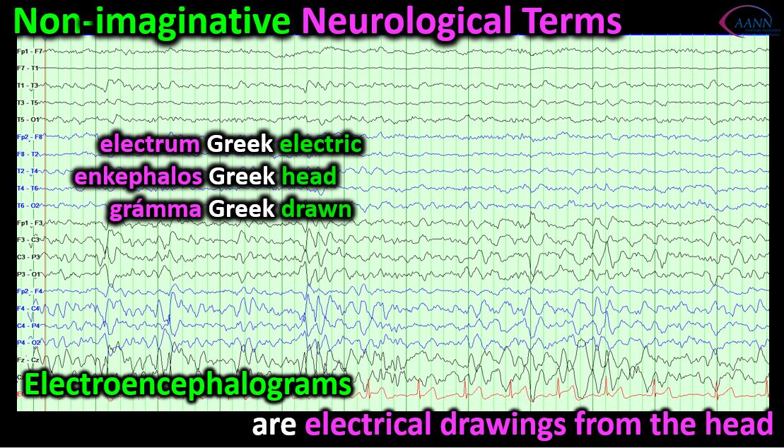 #Neuronurses know that an EEG is just a drawing that represents electrical activity inside the head. #neuronerds #nursepractitioner #EEG #epilepsy #Seizure #EMU doi.org/10.1097/jnn.00… @neuronursesaann