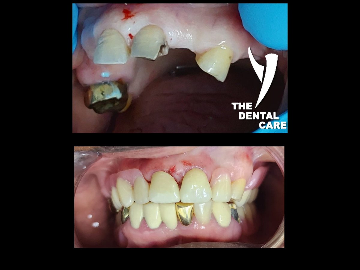 'As dental professionals, we understand the value of a confident smile. Despite financial limitations, we strive to enhance smiles, ensuring everyone can look and feel their best. #TheDentalCare #EmpoweringSmiles Senwabarwana village 081 578 6700 sekodental.co.za