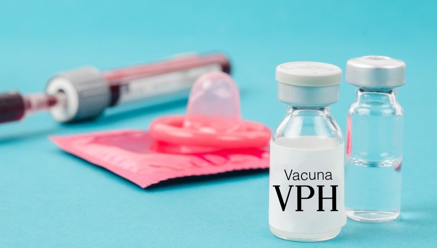#BoletínUNAM La vacunación y el uso de condón son los mejores instrumentos para luchar contra el virus del papiloma humano: #ExpertoUNAM > acortar.link/pEuJE9