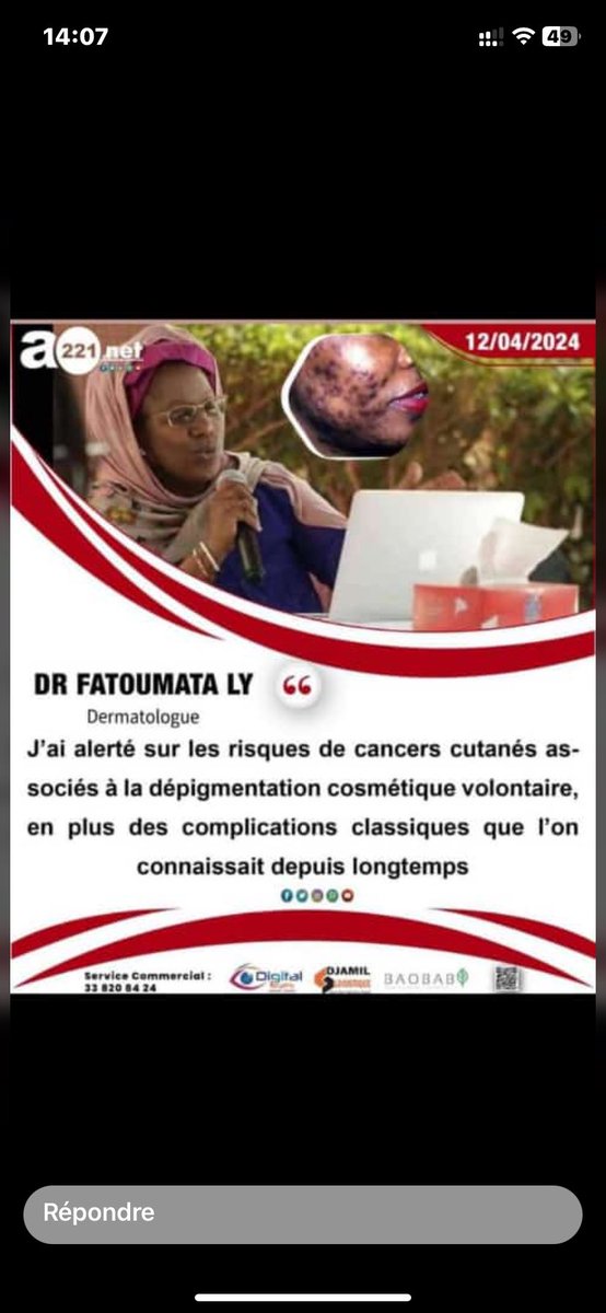 buAidaa's tweet image. Nguén né Dounguén bayi xeessal 😭
#StopDepigmentation
#ÑuulKukk