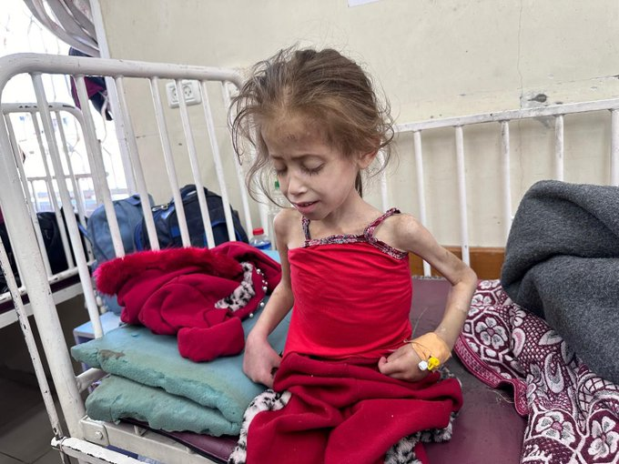 Seamus_Malek's tweet photo. This photo of a starving little girl in Kamal Adwan Hospital in northern Gaza has broken me. I am filled with inarticulable rage that I am able to see the ridges of her skull, the outline of the bones in her arms, her ribcage. https://t.co/Ot7tq0FvKi