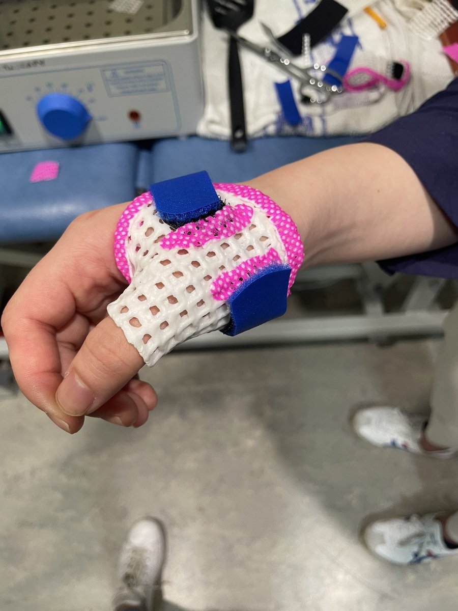 Chantelle_B21's tweet photo. Ex-lite splinting course today! Loving the pink edging π #handsplinting @manosplint @CathMcCoy #xlite https://t.co/q73DN7MaZc