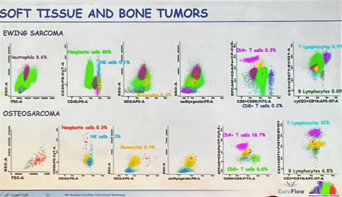_priteixeira_'s tweet photo. In D2 of Brazilian EuroFlow Educational Workshop a excellent class about Pediatric solid tumor evaluation by Cristiane Facio
#flowcytometry https://t.co/O8ttU1mCSR