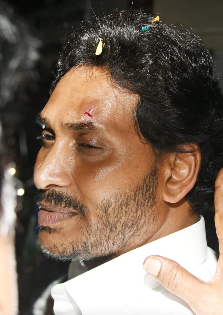 Venu4TDP's tweet photo. ఒక కోడి కత్తి 
ఒక బాబాయ్ గొడ్డలి 
ఒక విజయవాడ రాయి 😂😂 https://t.co/VcZDoVottN