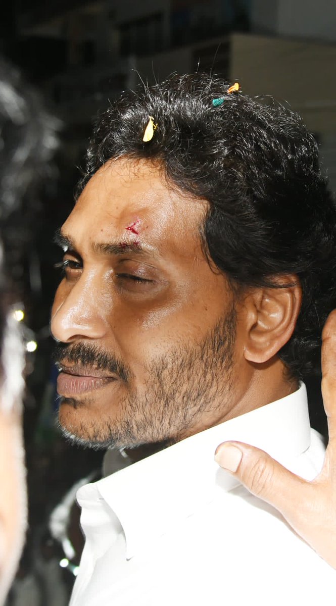 BhaskarBasava's tweet image. #Breaking: @YSRCParty alleges stone attack on its chief and CM @ysjagan during &quot;Memantha #Siddham&quot; Bus Yatra in #Vijayawada.

In the photo, #YSJagan is seen with an injury on his left eyebrow. 

@TheSouthfirst