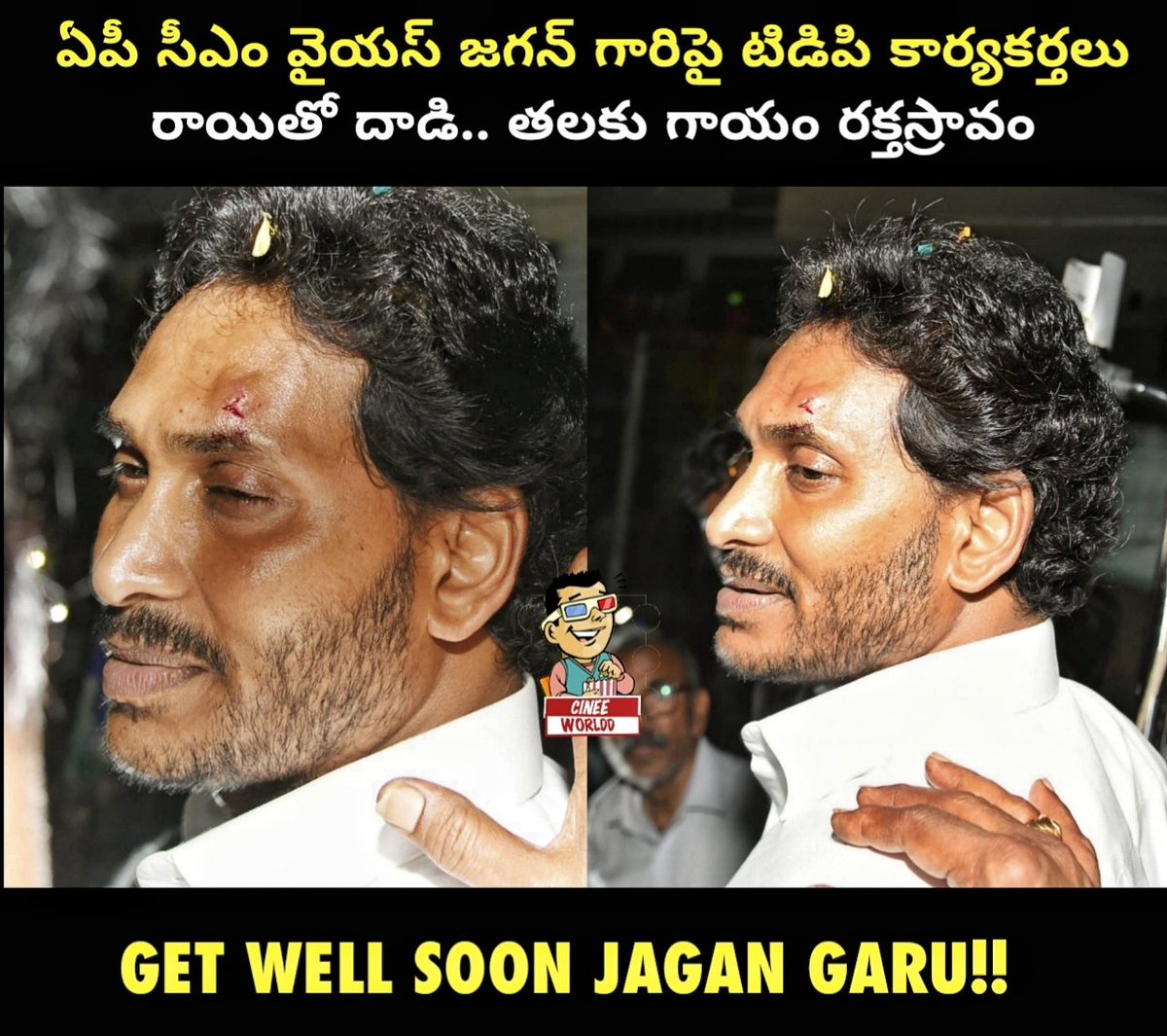 Wishing #YsJagan Garu A Speedy Recovery!!

#Siddham #MemanthaSiddham #Cinee_Worldd