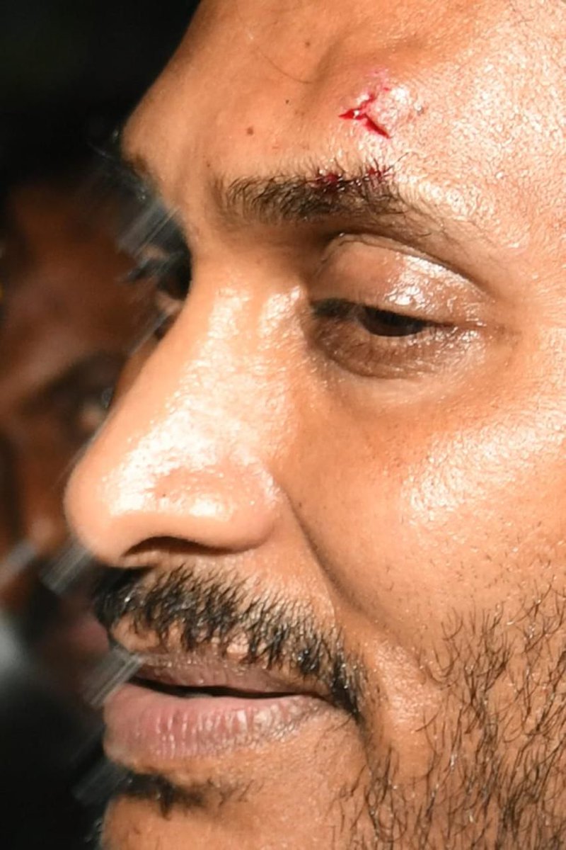 APCM @ysjagan hit with a stone as he was greeting people at @YSRCParty Vijayawada rally; injured above left eyebrow. Party MLA Vellampalli Srinivas too sustained injury in left eye. After first-aid treatment, Jagan continued his bus yatra. YSRCP alleges @JaiTDP involvement in act