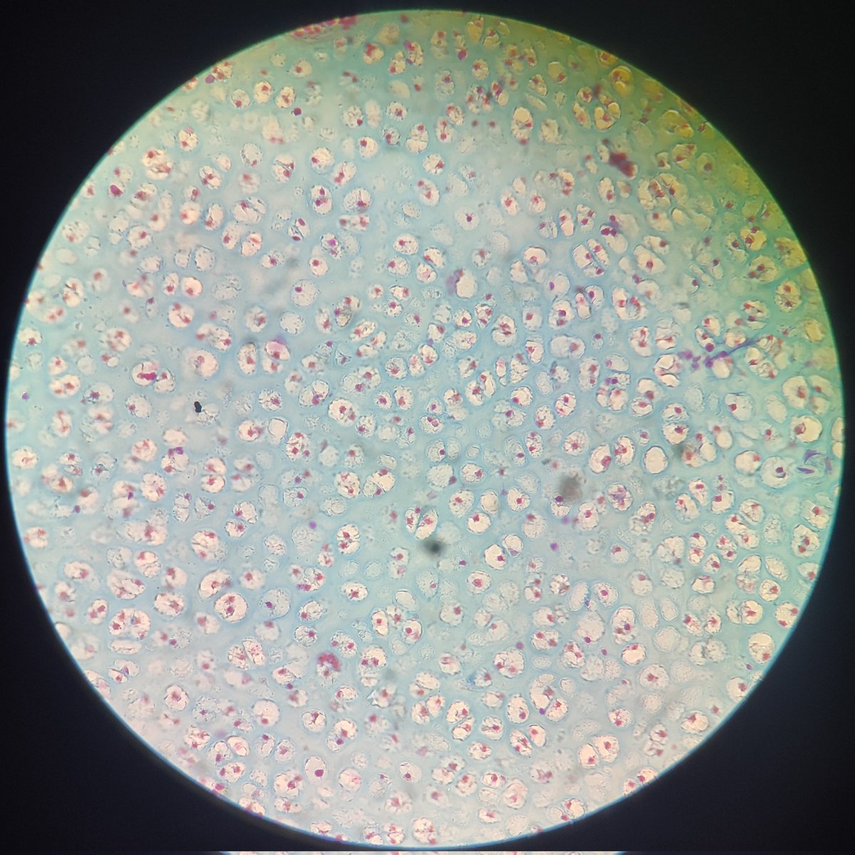 lvsbnlv's tweet photo. dumping my favorite CTs !!

white adipose - areolar
hyaline - dense reg elastic https://t.co/u0Zeas9Dhq
