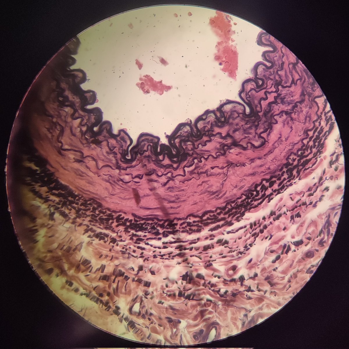 lvsbnlv's tweet photo. dumping my favorite CTs !!

white adipose - areolar
hyaline - dense reg elastic https://t.co/u0Zeas9Dhq