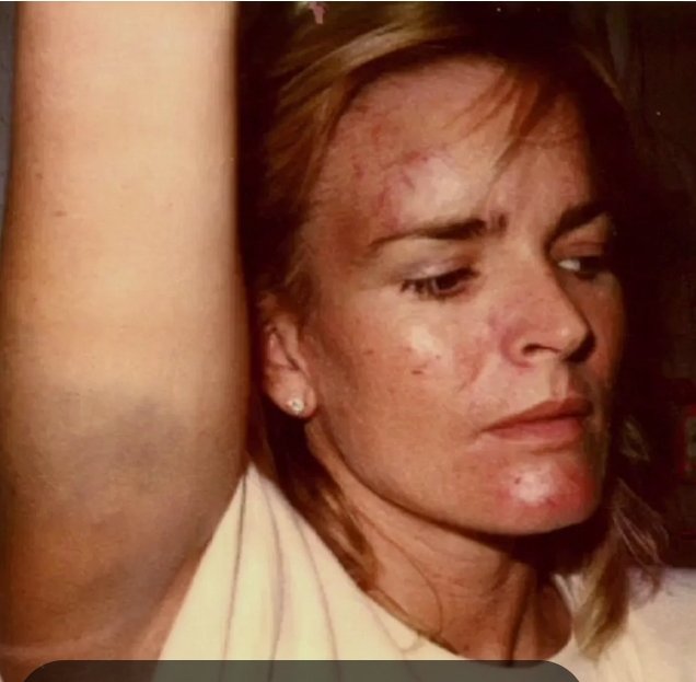 SpinningMyWebb's tweet photo. @lewishmiltton Nicole Simpson had been horribly beat on several occasions by OJ. Heard was a gold digger and lying abuser. Nicole was nothing like AH.
#AmberHeardIsALiar
#RIPNicole https://t.co/m04nl4vwBw