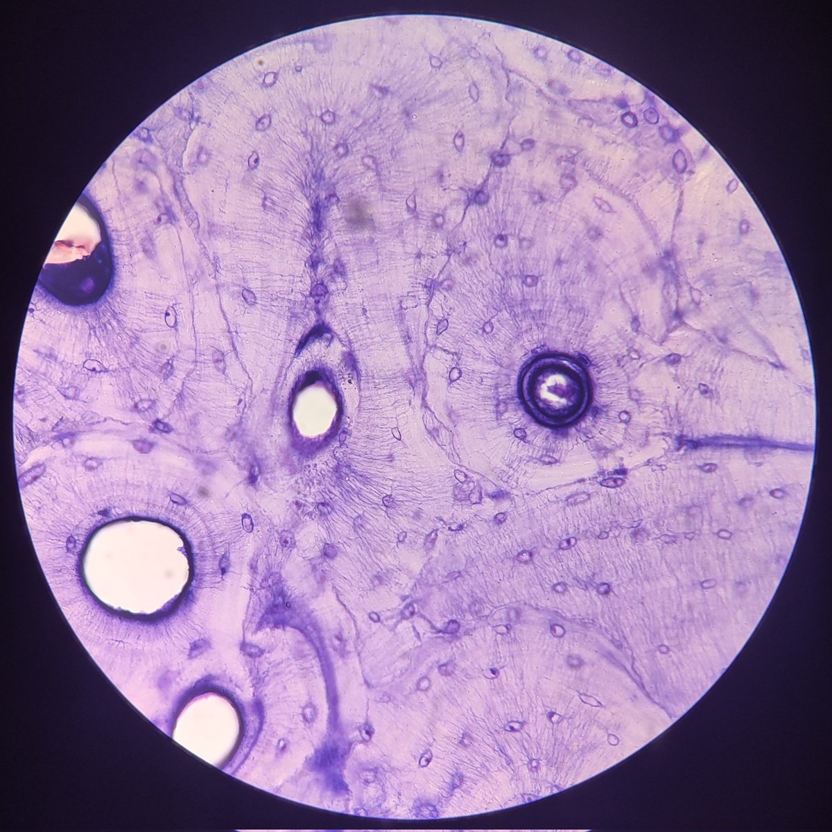 lvsbnlv's tweet photo. honorable mentions:

compact bone and reticular ct (na mukhang champorado at maraming gatas huhu) https://t.co/jryifIY7FM