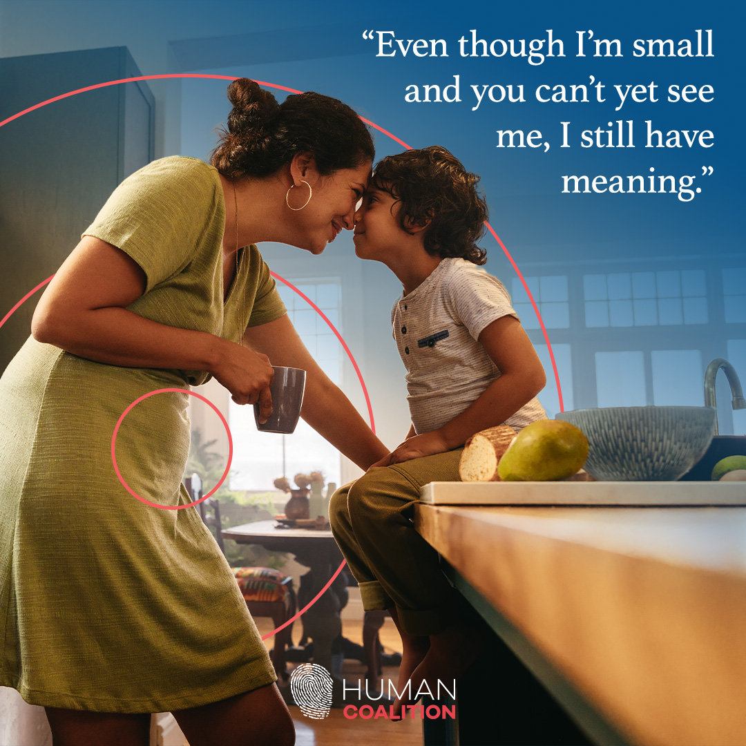 Rescue the preborn with us! Find out more at humancoalition.org 

#SaveTheBabyHumans #LifeIsAHumanRight #ValueLife #ChooseLife #EndAbortion #Abortion #ProLife #RescueThePreborn #HelpHurtingWomen #HelpTheHurting #HelpTheVulnerable #Preborn #RestoreFamilies