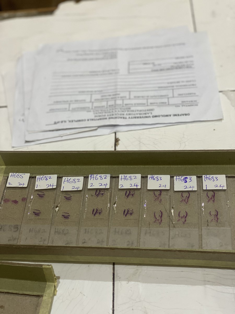 AjiOfMosho's tweet image. Frame 1 - slide stained and mounted 
Frame 2 - cases arranged with there cards respectively.
Frame 3 - sent to the quality control bench
#mlscommunity 
#histopath