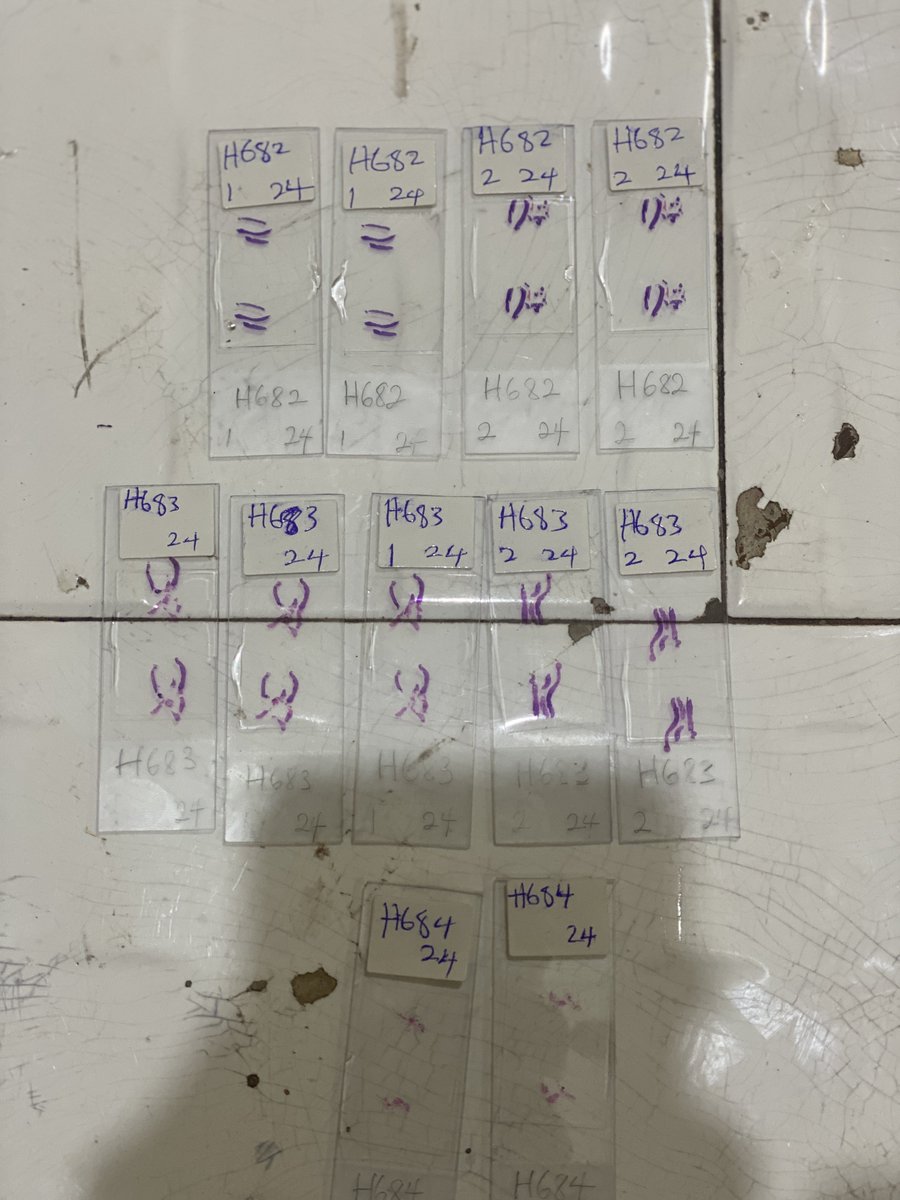 AjiOfMosho's tweet image. Frame 1 - slide stained and mounted 
Frame 2 - cases arranged with there cards respectively.
Frame 3 - sent to the quality control bench
#mlscommunity 
#histopath