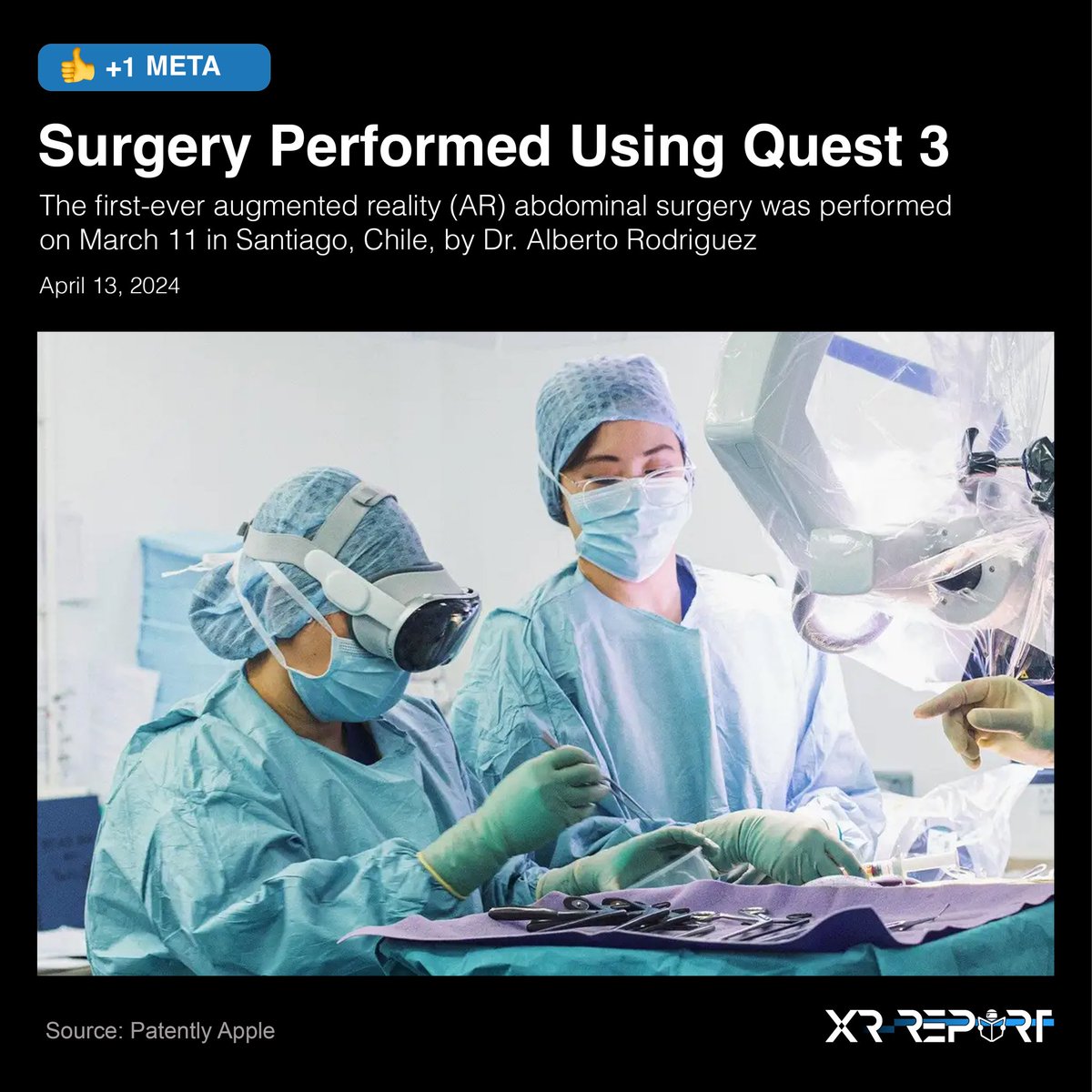 xrreport's tweet photo. 1st-ever XR abdominal surgery was performed using Quest 3
👍 +1 Meta | https://t.co/EMmzUvoZR5

The first-ever augmented reality (AR) abdominal surgery was performed on March 11 in Santiago, Chile, by Dr. Alberto Rodriguez.

Source: Patently Apple
Article Date: April 13, 2024 https://t.co/8C0kkufxFw