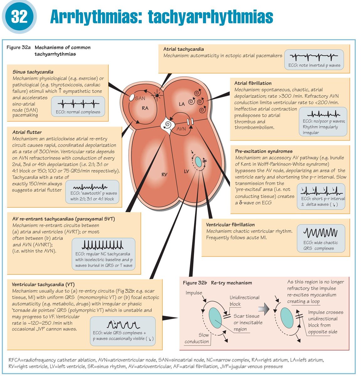 ResusMed's tweet photo. Arrhythmia: Tachyarrhythmias https://t.co/Rk5oL5CpkK