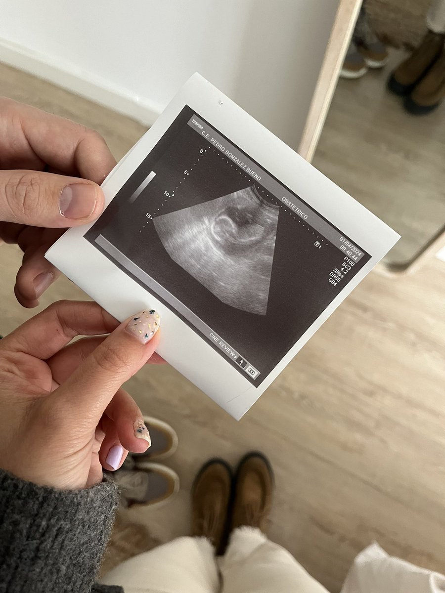 Jorge Higuera Díez 🍏 tweet media