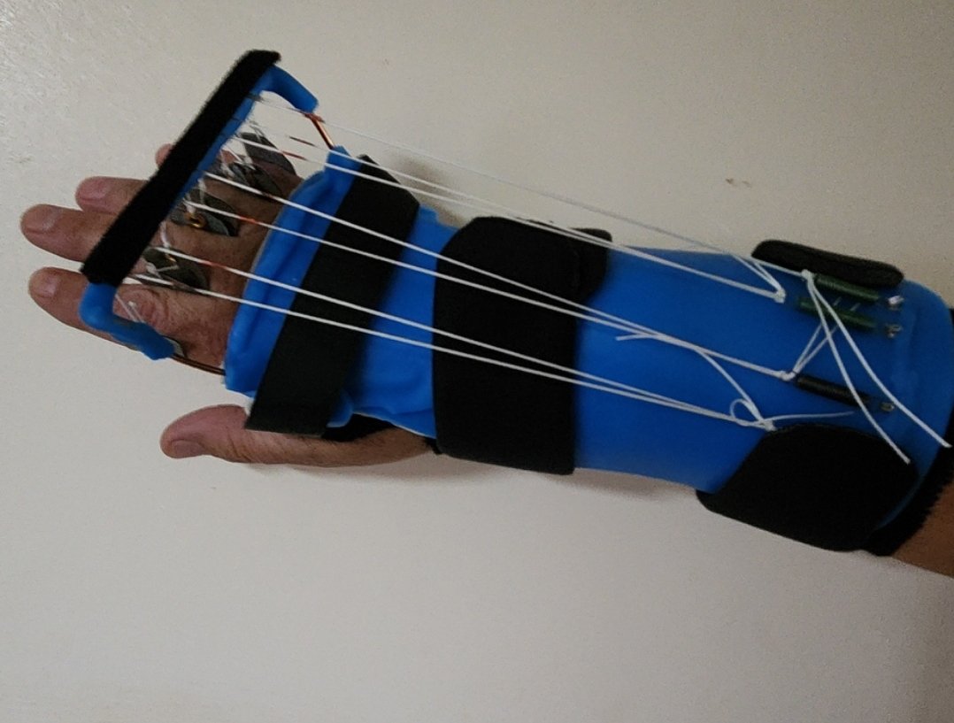 ki5qyy's tweet photo. Sliced my forearm accidentally at work... took out 6 tendons . Had to have emergency surgery because I couldn't move my fingers.  Able to move them all now. Have weeks of therapy!

The cut across sideways is mine.  The up and down cuts are from the doctors..

Nickname: Zoro-Borg https://t.co/DDVNI1Iwxe