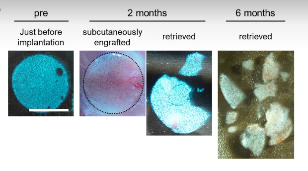 📢 New in @PNASNews! Researchers at @KyotoU_News have identified proliferative off-target cells, termed proliferative #mesenchymal stem cells, that emerged unexpectedly after the implantation of iPSC-derived pancreatic #IsletCells. 🔗: bit.ly/3VT4PP9